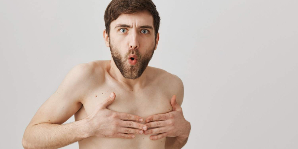 Gynecomastia in Islamabad: Look Strong, Feel Strong