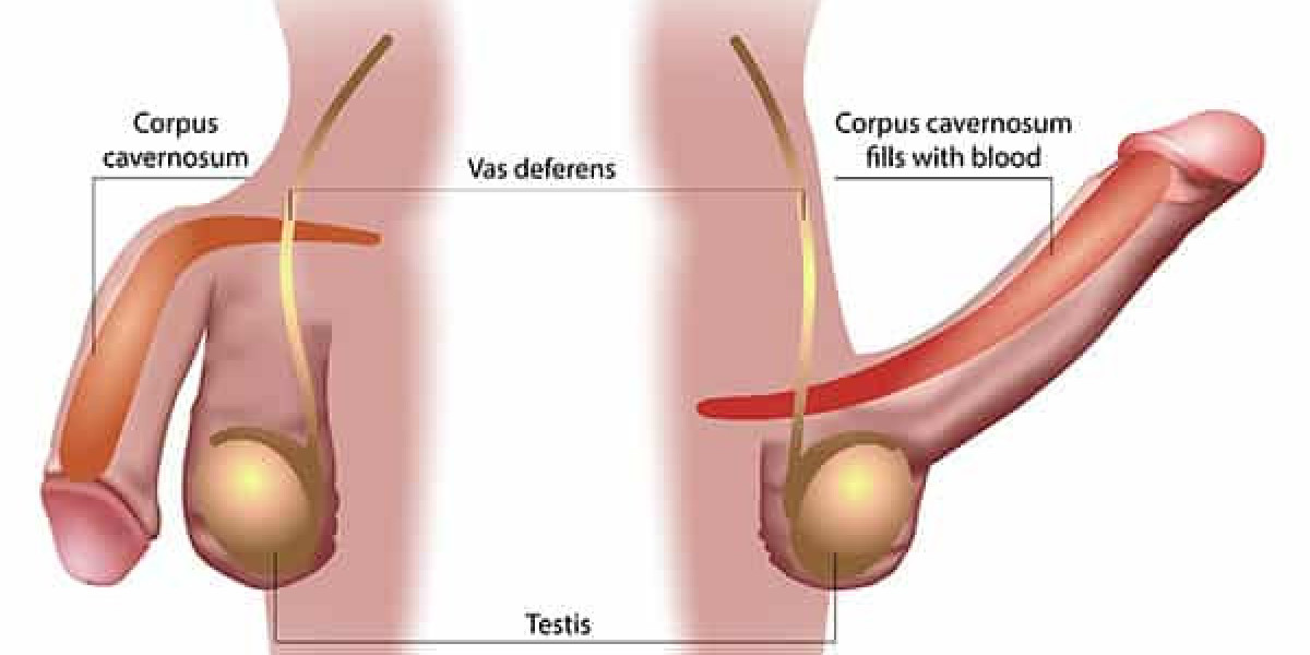Can Vidalista 80mg Improve Confidence in ED Patients? Benefits, Safety, and Expectations