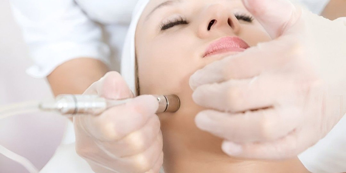 Microdermabrasion in Islamabad for Fresh Youthful Glow