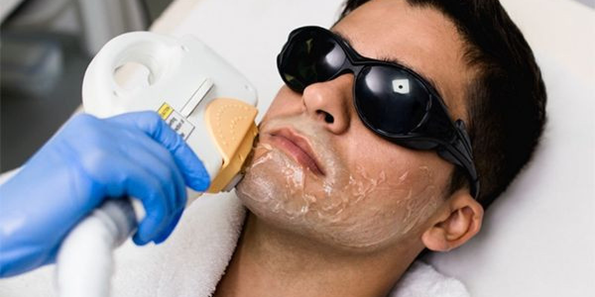 How Laser Hair Removal in Islamabad Can Transform Your Lifestyle