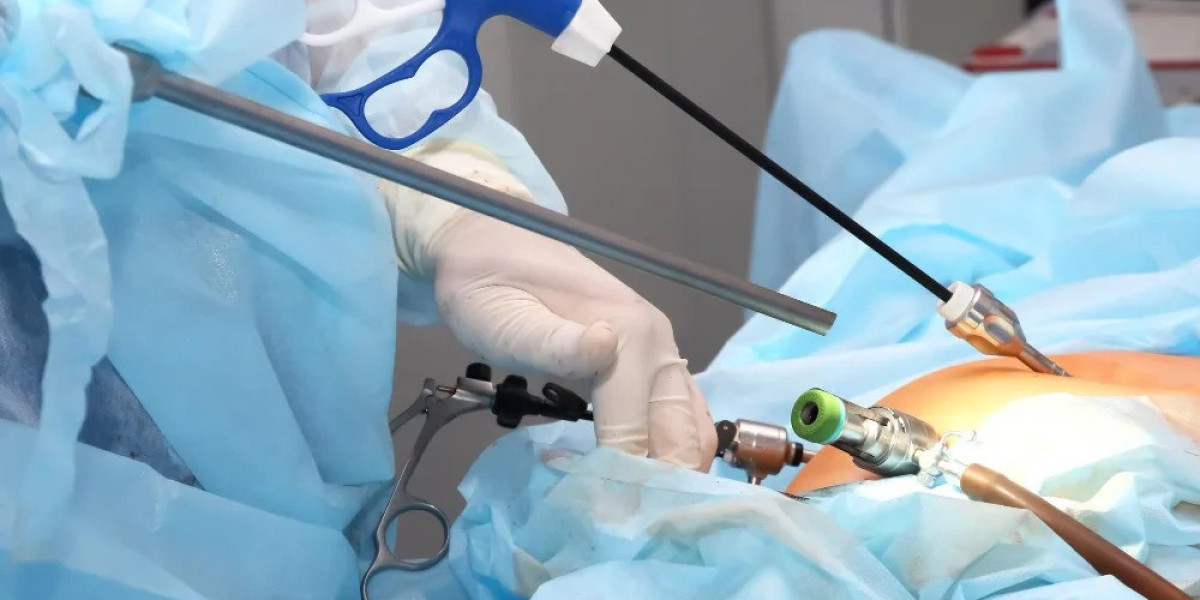 Minimally Invasive Surgery for Obesity: Laparoscopic Options