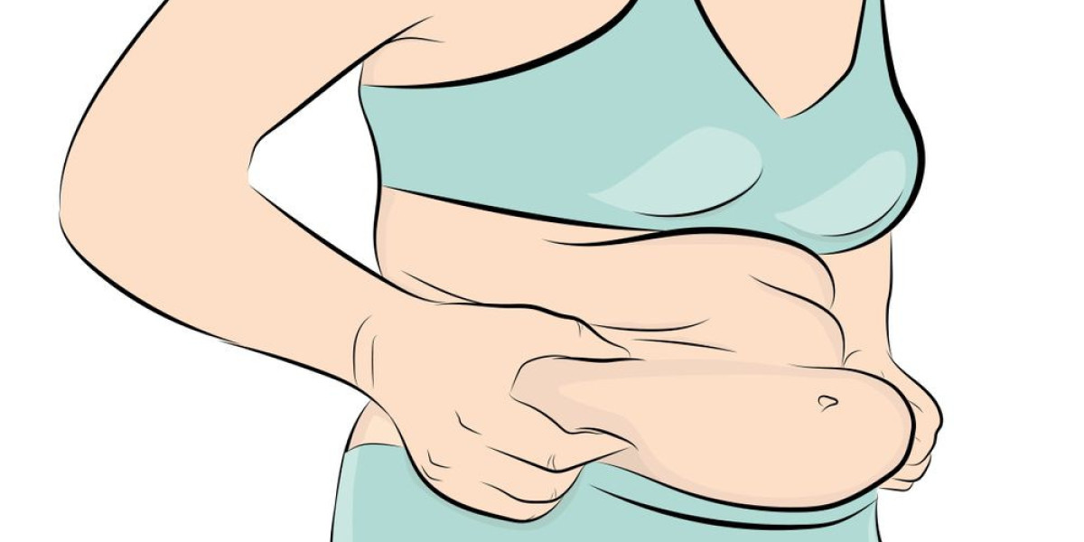 Abdominoplasty in Islamabad: Sculpt Your Abdominal Profile