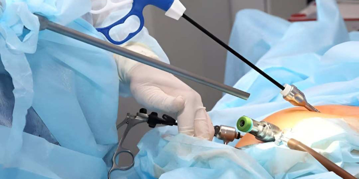 Care You Trust: Laparoscopic Surgery in Islamabad