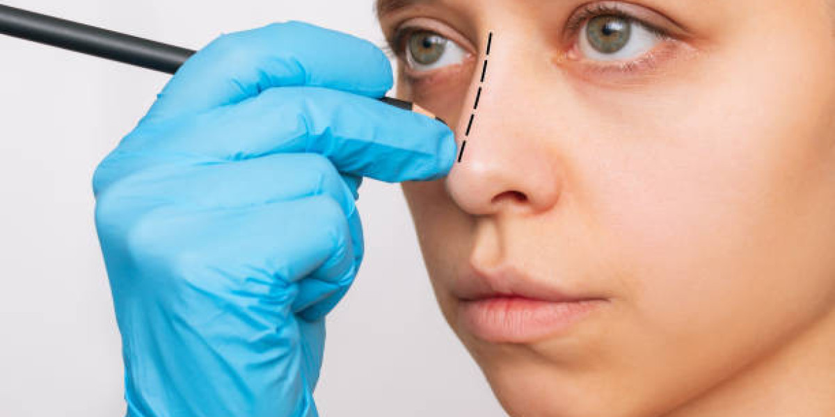 تجميل الأنف في دبي: الحل الأمثل لتحقيق التوازن المثالي لوجهك