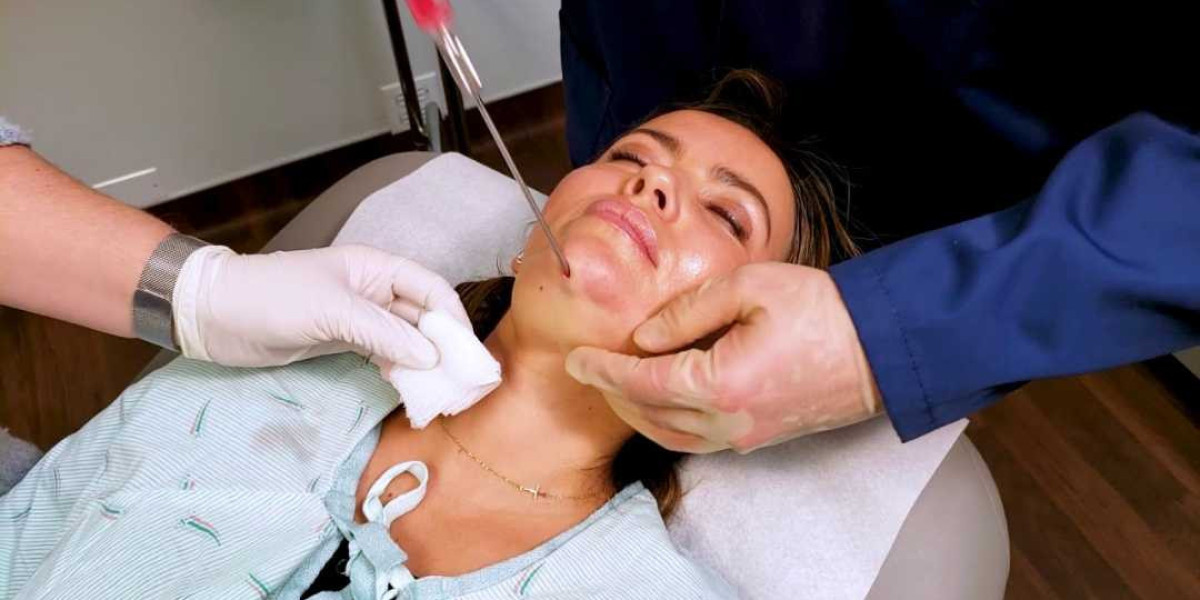 Get Rid of Double Chin Liposuction Islamabad