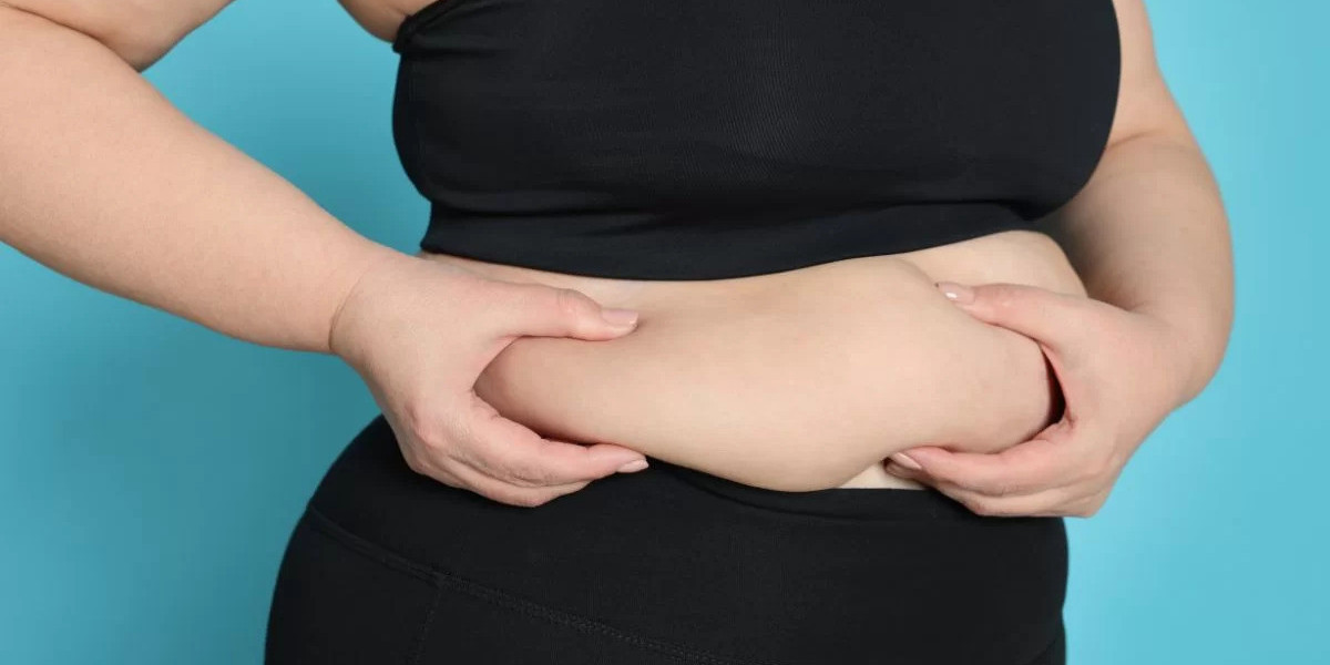 Bariatric Surgery in Islamabad – Complete Guide.