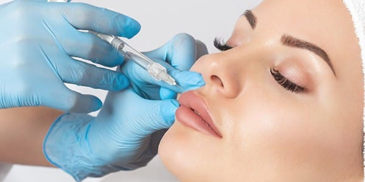 Lift Your Confidence with Fillers