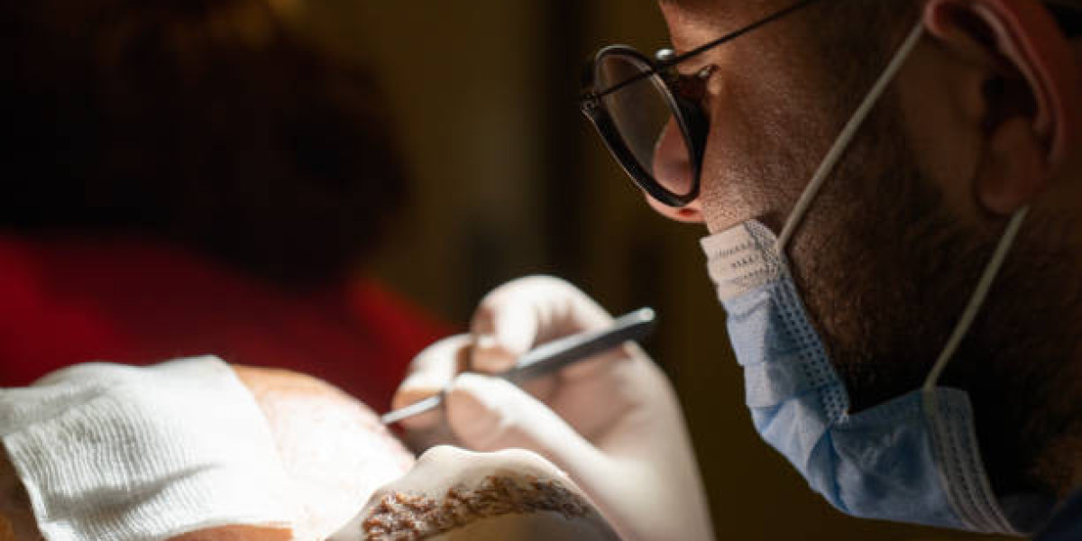 FUE Hair Transplant in Islamabad – Effective, Natural Hair Restoration