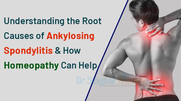 Top Causes of Ankylosing Spondylitis | Early Signs & Tips