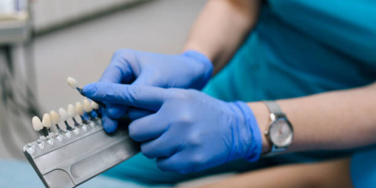 Get a Radiant, Confident Smile with Dental Veneers