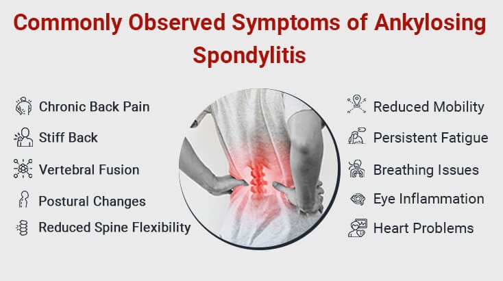 Spondylitis Affects Which Part of the Body | Dr. Vikas Singhal