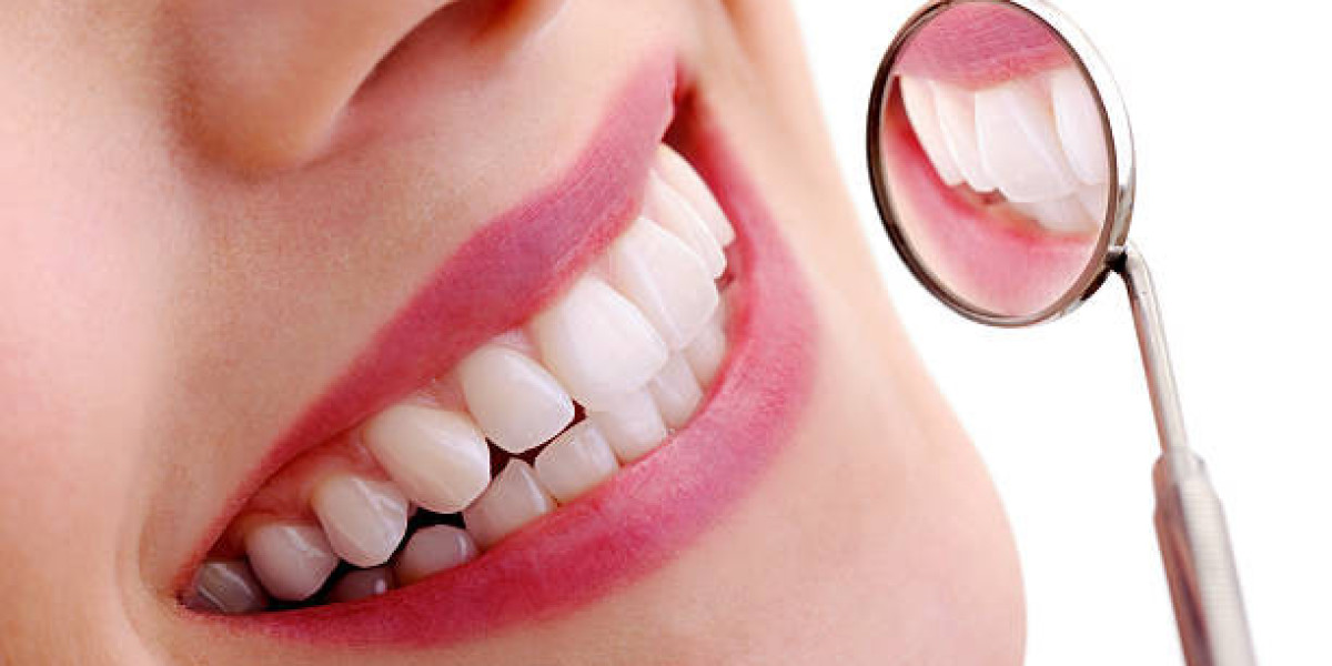Smile Brighter with Teeth Whitening in Islamabad
