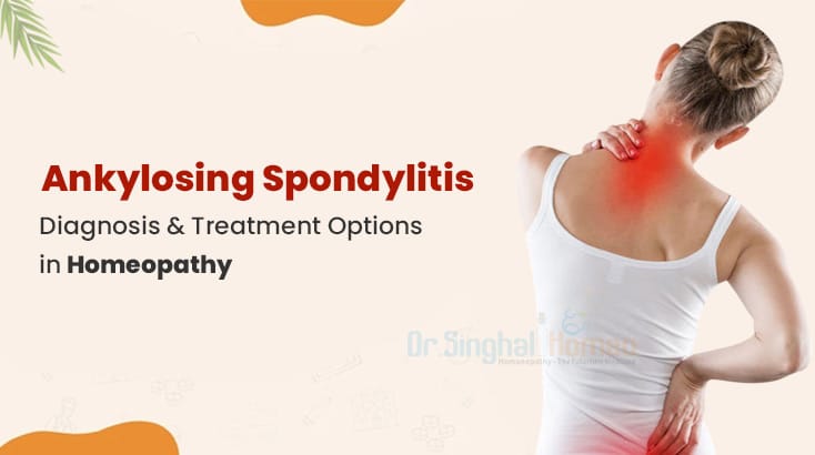 Ankylosing Spondylitis Diagnosis & Management | Dr. Vikas Singhal