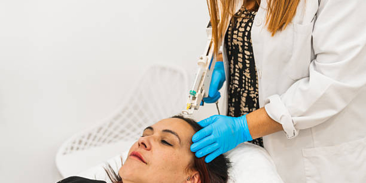 PRP Hair Treatment in Islamabad – Natural Hair Regrowth Solution