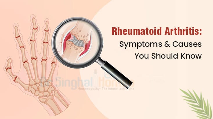 Understanding Rheumatoid Arthritis: Symptoms & Causes