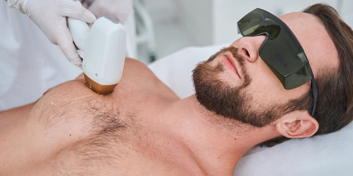Laser Hair Removal in Islamabad: A Safe and Effective Way to Smooth Skin