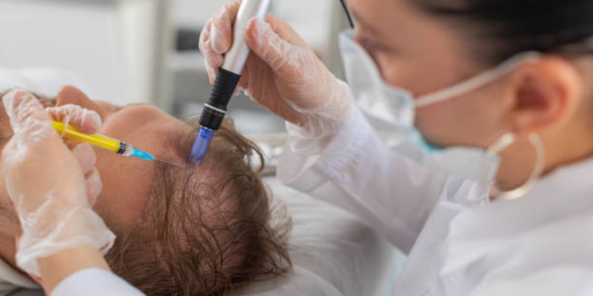 Alternatives to Exosome Hair Therapy in Islamabad: Which Treatment Should You Choose?