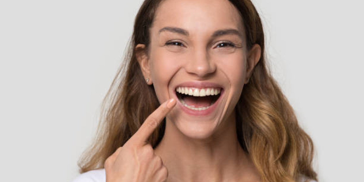 Hollywood Smile in Islamabad: Modern Smile Transformation with Cosmetic Dentistry