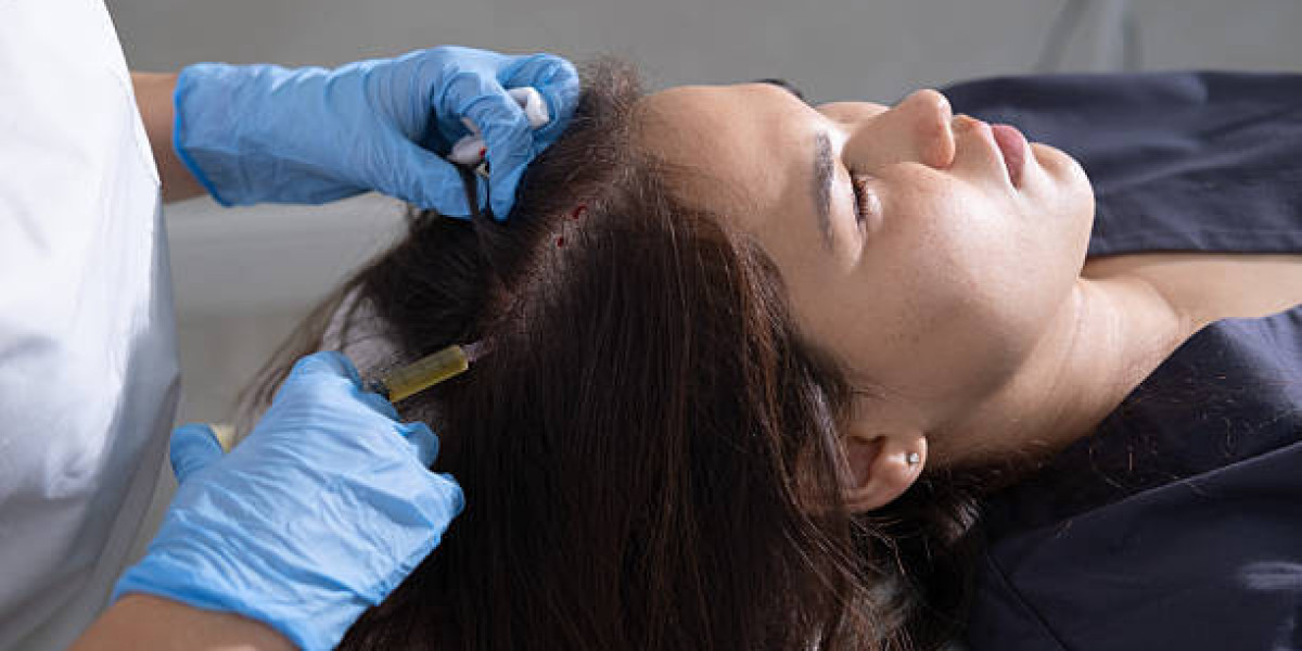 PRP Hair Therapy Cost Complete Price Guide 2026: