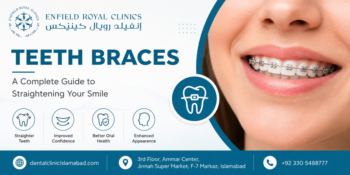 Why Teeth Braces in Islamabad Pakistan Are Important for Correcting Overbites