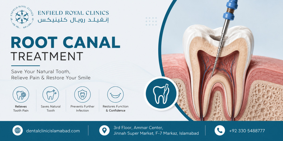 Save an Infected Tooth Root Canal Treatment in Islamabad Pakistan The Best Way to :