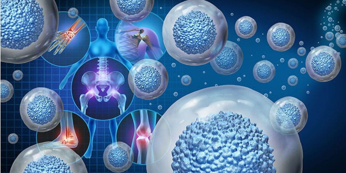 PRP vs Stem Cell for Skin Renewal and Treatment Options